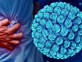Examining climate-driven influences on norovirus transmission and disease patterns